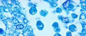 Brain-eating amoeba, Naegleria fowleri