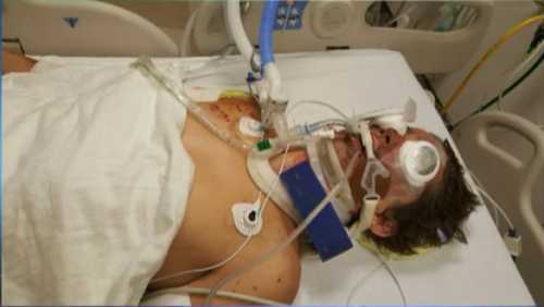 Rowdy Radford, 15, injured by a homemade "sparkler bomb" in Sargent, Texas