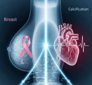 Mammogram can show calcifications, early signs of heart disease